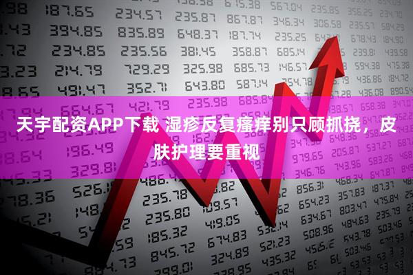 天宇配资APP下载 湿疹反复瘙痒别只顾抓挠，皮肤护理要重视
